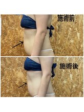 ピュアトゥルー 岐阜西店(PureTrue)/ウルトランスフォーマー