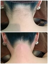 エン(en.)/BeforeAfter写真44