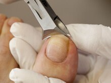 ブルーム(bloom)/