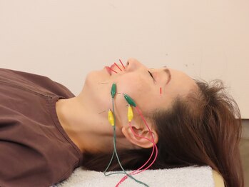 シフク鍼灸整体院/電気鍼