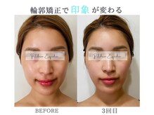 プルチャームエクイデム(Pulchram equidem)/ヘッドスパ+頭蓋骨矯正+小顔矯正