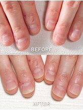 ポメロ(POMELO)/むしりたくなるササクレも除去