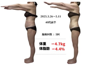 ラヴィ アール(Lavie.R)/痩身/リンパ/リンパマッサージ