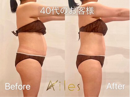エール 恵比寿店(AILES)の写真