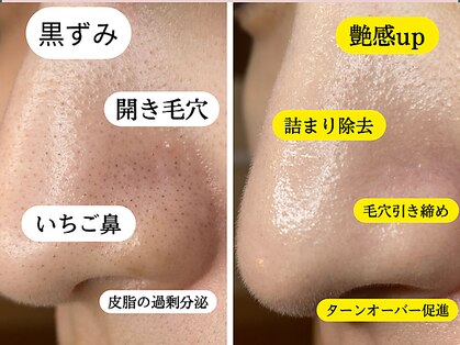 サイ(Sai)の写真