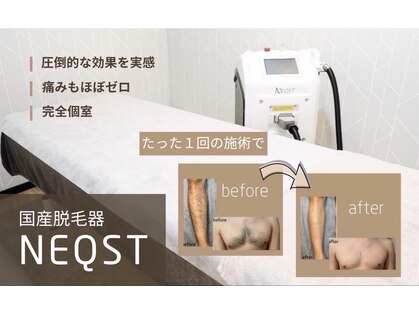 ヴィシアス(VIXIAS)の写真