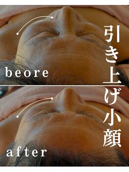 ニワ(Niwa)/ヘッド施術結果例