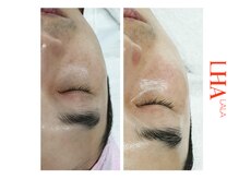 シューラディアント(ShuRadiant)/韓国ララピール