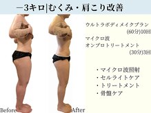 京都フォーエイチ(京都4H)/むくみ・肩こり・反り腰改善