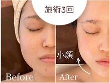 キュート 川越店(Cute)の雰囲気（結果重視◎【小顔×美肌】ダウンタイムなしで即日小顔になれる）