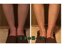 リーズサロン(REs.salon)/【40代・立ち仕事】足首に筋が!!