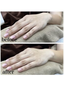 ラクシー 御徒町(luxssy)/指先シェービング