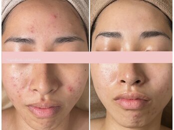 エイプリルフールズ(April fools)