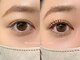 リノ(Lino)の写真/まつげパーマでお悩み解決！豊富な種類のロッドをご用意◎理想の目元をご提供♪上下SETメニューも◎