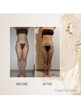 クーラ テュセ(Coeur la Tusais)/【40歳まで】全身まるごと痩身