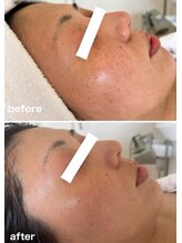 アリュール(Allule)/