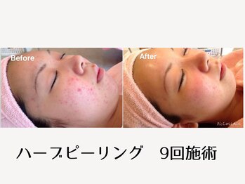 フアリト 江坂店(Fuari-to)/Before After2