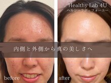 ヘルスラボフォーユー(Health Labo4U)の雰囲気(丁寧な施術と結果にこだわるスキンケアで一度で体感♪)