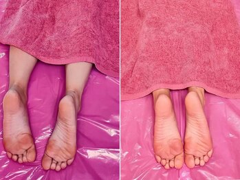 美容整体カラダリメイク(karada)/骨盤矯正ダイエットの結果