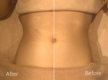 ボディッシュ 天満橋店(Bodysh)/ 痩身リンパで汗かいてDetox