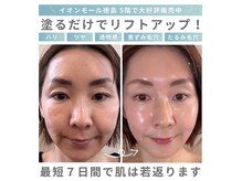 エクラ イオンモール徳島店(ECLAT)の雰囲気（根本から肌を変える/ハリツヤ改善/インセルダム正規販売店）