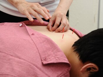 おちあい鍼灸整骨院の写真/◇首・肩まわりをすっきりリセット◇当日予約◎「整体×鍼灸」の集中ケアで、明日のデスクワークも快適に