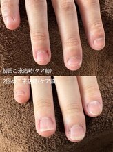 ビビィ(vivie)/ジェルを使わず育爪できます