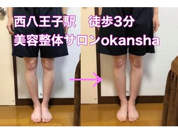 美容整体サロン オオカンシャ(okansha)/O脚Before→After