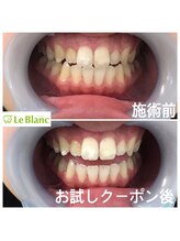 ルブラン 奈良店(Le Blanc)/気になるホワイトスポットは。。