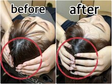 ライトワーク 西新宿店/小顔矯正