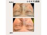 《シミケア》最新光フェイシャル&美容液導入