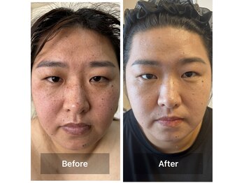 サロン ド アヤ(salon de Aya)/月2回ご来店・4ヶ月間の変化