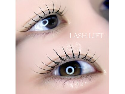 ルル(LuLu)の写真