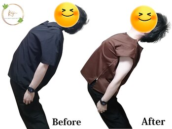 慧仁治療院/腰痛改善