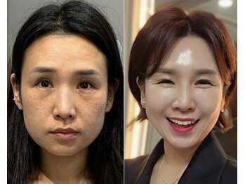 ICDスキンスタジオ 新宿三丁目(ICD-skin studio)/Before-After