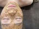 ペア(pe'a)の写真/ハーブピーリングで美肌管理♪毛穴ケアも◎光フェイシャルでシミ・くすみ改善、たるみケアもおすすめです★