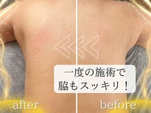 ラジュワード(lajward)の雰囲気（もたつく脇もシルエットが変わります◎）