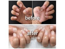 和(nagomi)の雰囲気(深爪さんも3ヶ月でここまで変わりました。)