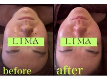 サロンドリマ(Salon de Lima)の雰囲気（小顔マッサージ後フェイスラインが変化しました！）
