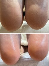 キュール(CUOOL)/素足美人にはお手入れコースが◎