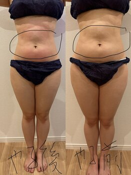 ラフィネ(Raffine)/一回だけ効果があります