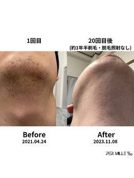 パーミル 楠葉店(per mille‰)/Before/After