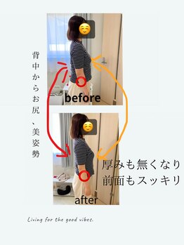 ララ(LALA)/姿勢改善