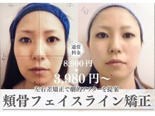 モアフェイス 池袋店(More Face)の雰囲気（小顔矯正・造顔・脂肪撃退リンパマッサージでリフトアップ！）