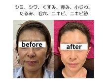 県庁通り整体院の雰囲気（肌質改善フェイシャル◇光フェイシャル/ハーブピーリング/浦和駅）