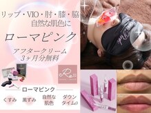 リプラス(Replus)