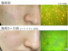 ナーススキン(nurse skin)の雰囲気（スキンチェッカーで肌を分析。今の正確な肌状態を把握します♪）
