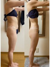 クレビア 吉祥寺店(CREBIA)/エンダモロジー/痩身/吉祥寺