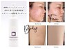 【リベルが初めての方限定/FaceまたはBody】エクソソーム美容液プレゼント