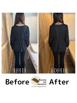 クマの冬眠 高知店/産後ケア